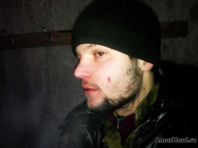 пуля в щеке пуля в щеке