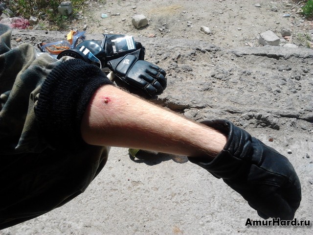 ранение из пневматического пистолета ранение из пневматического пистолета