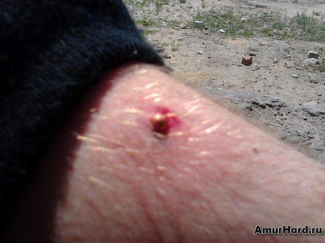 травма от пневматики травма от пневматики