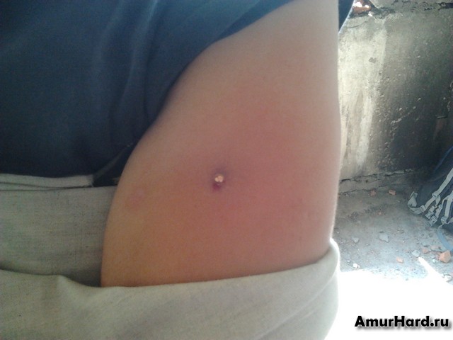 пуля от пневматики в руке пуля от пневматики в руке