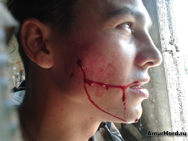 ранение в голову из пневматики ранение в голову из пневматики