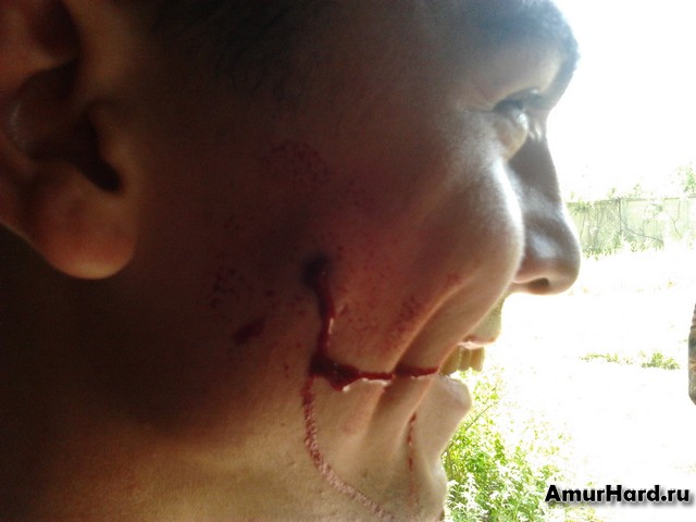 кровь на голове от пневматики кровь на голове от пневматики