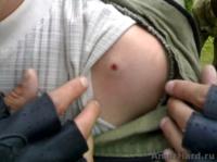 последствия пневматики