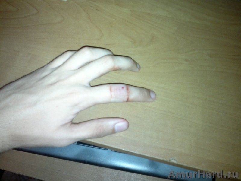 хардбол ранения хардбол ранения