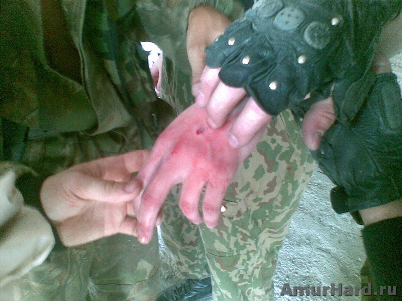 хардбол ранения хардбол ранения