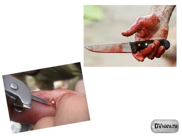 Убитый - Сленг Убитый - Сленг