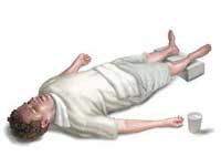 Обморок Обморок