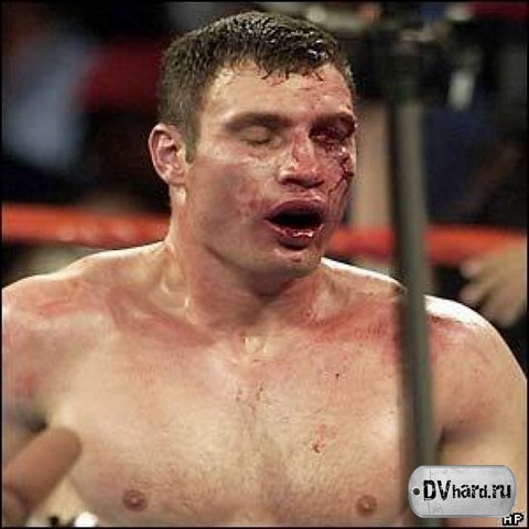 травмы не в хардболе травмы не в хардболе